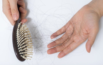 How Much Hair Loss Is Normal? 