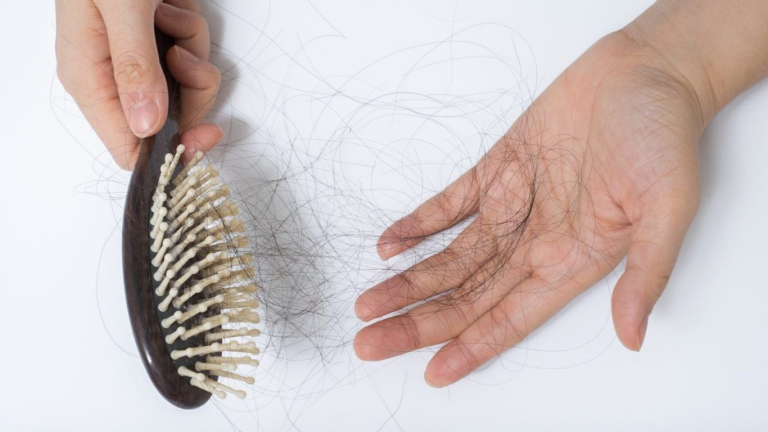 Hair Loss